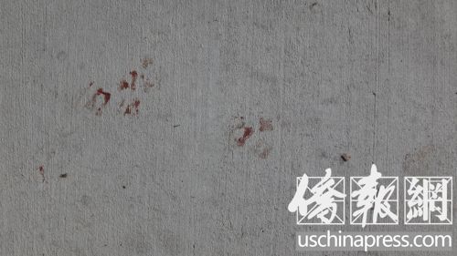 �Tǰˮ�����������Ҋ�׵�Ѫ�E��(�������S��(b��o)��/��� �z)