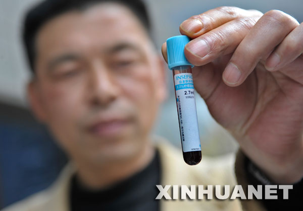 �������؈����M�о�Ӌ����һ���֣��Ĵ��P������؈�о����ĵĿ����ˆT�����؈?zh��)�ȡѪҺ�ӱ����z��2008��3��20�գ��� 10��11�����Ї��ƌW�������������������׏�����؈����M���ЈD�V�L�������ԓ�D�V���Q�����a�˴���؈����M����������W�о��Ŀհ����Ļ���M�W�Č����Ϟ�lΣ��N�ı��o�������O(ji��n)�ؼ��˹���ֳ�ṩ�˿ƌW����(j��)�� ���A��ӛ�� ���� �z