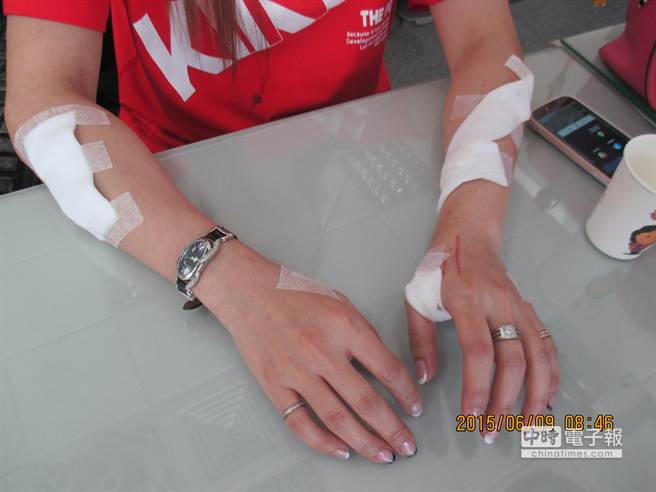 臺灣37歲離婚女為博初中同學(xué)關(guān)心 竟自殘謊稱遭性侵 臺灣37歲離婚女為博初中同學(xué)關(guān)心 竟自殘謊稱遭性侵