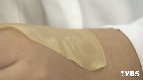 臺(tái)灣爆炸傷者被燒燙傷“南皮北送”仍不夠(圖)