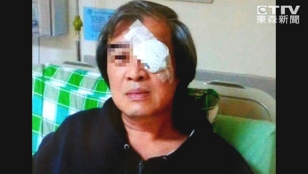 男子疑為詐保2200萬 制造假車禍“戳瞎”左眼 男子疑為詐保2200萬 制造假車禍“戳瞎”左眼