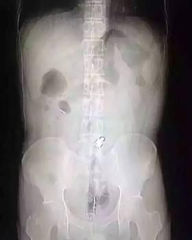 ���Ӹ��T����20�����L���� �Q���������