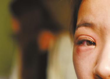 ëë��һֻ�۾��܂��t�[��