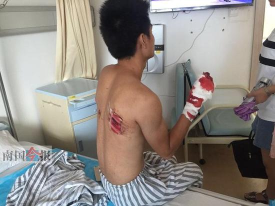 柳州一發(fā)廊煤氣爆燃4人受傷 沖擊波