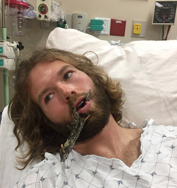 ����ѩ�̾���ѩ�r(sh��)������ �촽����֦�̴�