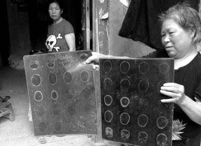 ��Ҋ(ji��n)־ĸ�H������(d��ng)���Ҋ(ji��n)־���H�^�����҂���CTƬ�������A�r(sh��)��(b��o)ӛ�� ����єz